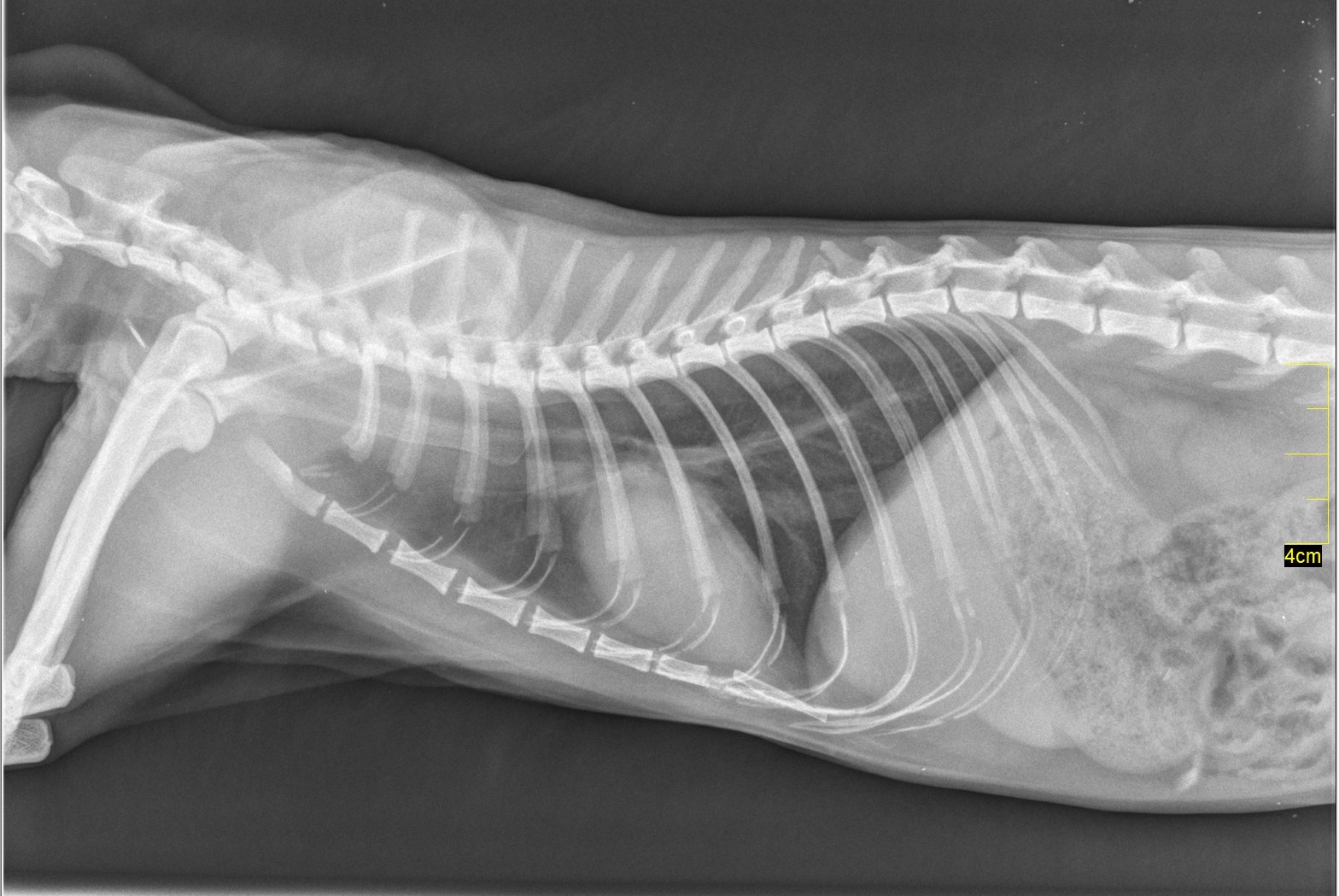 Radiographie numérique